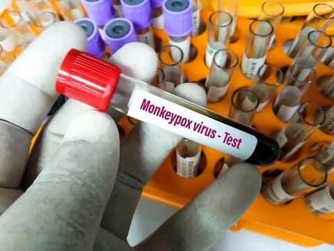 All sectors in UAE, in coordination and cooperation with competent authorities, are continuously evaluating and examining the epidemiological situation regarding monkeypox, both locally and globally.