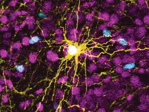 This microscope image provided by Pasca Lab/Stanford Medicine shows a human astrocyte cell, center in yellow, and human glial cells (scattered in blue) inside the brain of a rat.