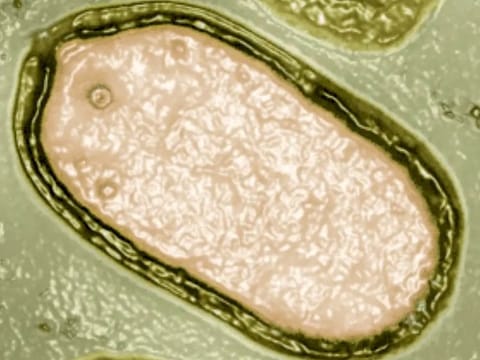 Scientists have warned about the revival of the so-called ‘zombie virus’. Global warming is irrevocably thawing enormous swathes of permafrost, which had the unsettling effect of "releasing organic materials frozen for up to a million years" - possibly deadly germs included.