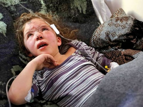 Seven-year-old Jana Al Abdo, who was pulled from under the rubble after a 50-hour rescue operation caused by an earthquake that hit Syria and Turkey, receives treatment at a hospital run by the Syrian American Medical Society near the Bab Al Hawa border crossing with Turkey in the north of Idlib province. Jana is one of untold numbers of orphans left by the 7.8 magnitude quake.