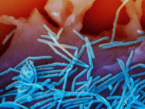 This electron microscope image provided by the National Institutes of Health shows human respiratory syncytial virus (RSV) virions, colorized blue, and anti-RSV F protein/gold antibodies, colorized yellow, shedding from the surface of human lung cells. The U.S. approved the first vaccine for RSV on Wednesday, May 3, 2023 shots to protect older adults against a respiratory virus that’s most notorious for attacking babies but endangers their grandparents, too.