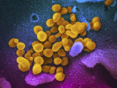 This undated, colourised electron microscope image made available by the US National Institutes of Health in February 2020 shows the Novel Coronavirus SARS-CoV-2, indicated in yellow, emerging from the surface of cells, indicated in blue/pink, cultured in a laboratory. The National Institutes of Health is opening a handful of studies to start testing possible treatments for long COVID, an anxiously awaited step in US efforts against the mysterious condition.