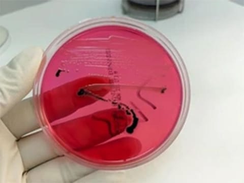 Salmonella is a bacterium commonly found - and spread - through the feces of animals or people, often through unsanitary agriculture or food handling practices.