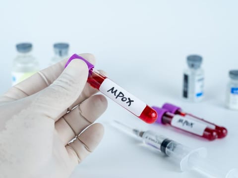 The mpox outbreak has swept through several African countries, particularly the Democratic Republic of Congo.