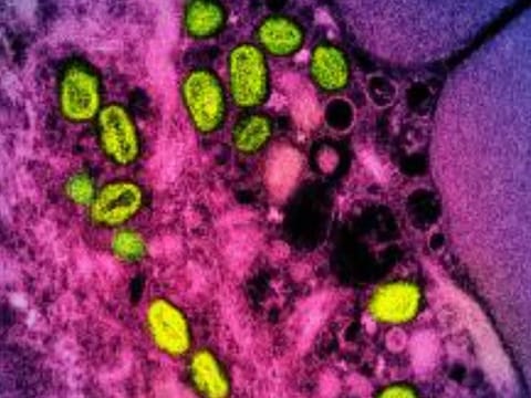 A colorised transmission electron micrograph of mpox particles (green) found within an infected cell (pink and purple), cultured in the laboratory.