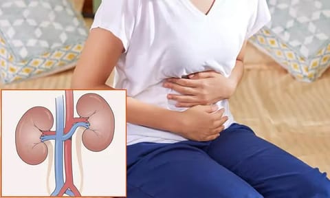 நீர்கடுப்பு