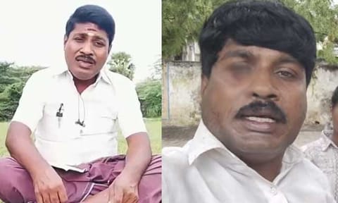 யூடியூபர் ஜி.பி.முத்து மீது தாக்குதல் - ரத்த காயத்துடன் வீடியோ வெளியிட்டதால் பரபரப்பு 