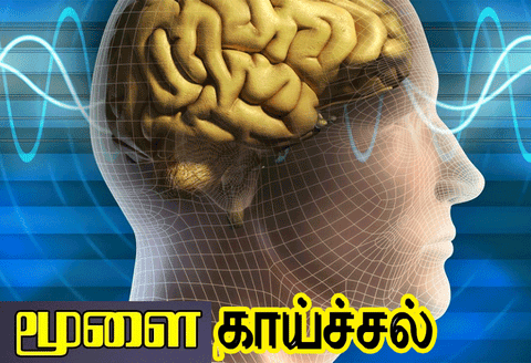 எருமப்பட்டி, பரமத்தியில் மூளை காய்ச்சல் விழிப்புணர்வு பயிற்சி