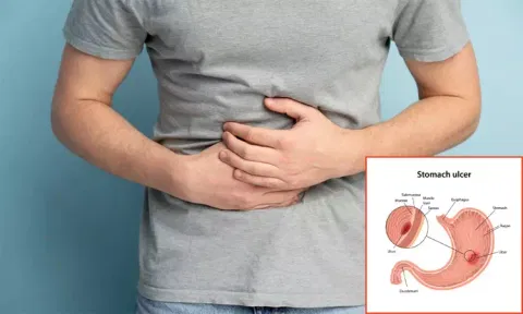 வயிற்றுப் புண்கள் குணமாக சித்த மருத்துவம்