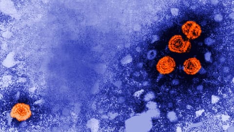 This 1981 electron microscope image made available by the U.S. Centers for Disease Control and Prevention shows hepatitis B virus particles, indicated in orange. 
(Photo: AP)
