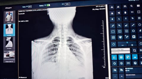 Picture of an X-ray