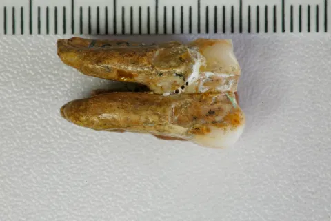 Ancient teeth