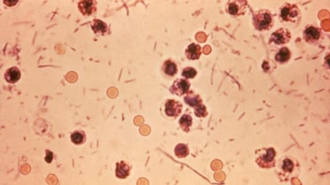 Shigella virus