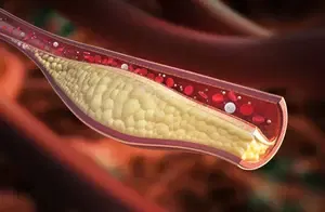 Sclerostin key protein for cardiovascular health in patients with diabetes: Study