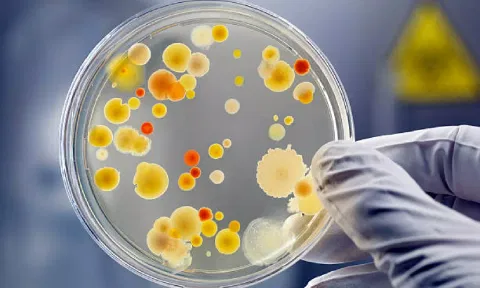[Representative image]