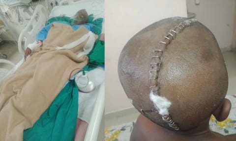 Injured student