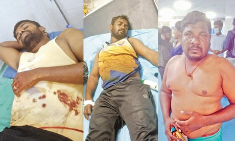 &nbsp;Fishermen have been admitted to the Orathur Government Medical College Hospital