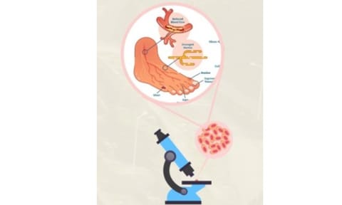 Representative Image (Photo: IANS)