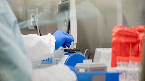 Representative image