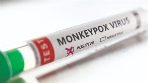 The kit would help in early detection.