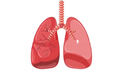 World TB Day: Delay in diagnosis a major challenge, say experts