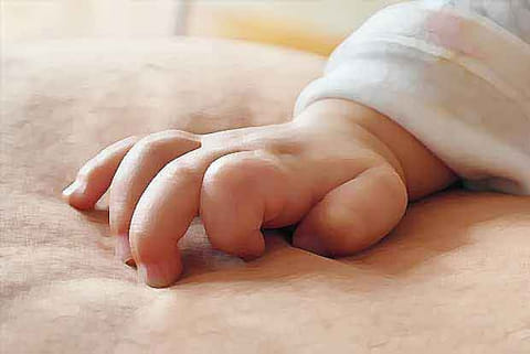 Representative image