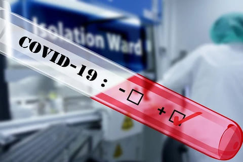 Testing COVID-19 positive: Advised home care for mild cases