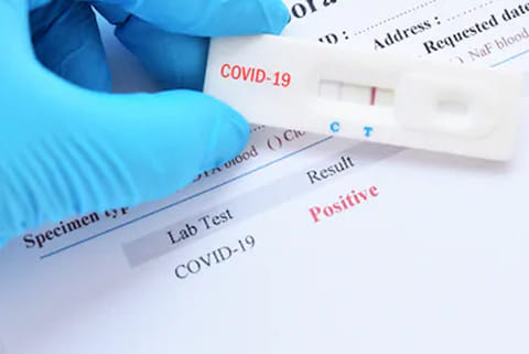 Sample test count crosses 20L in State, infant among 75 deaths