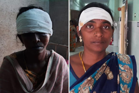 The injured women