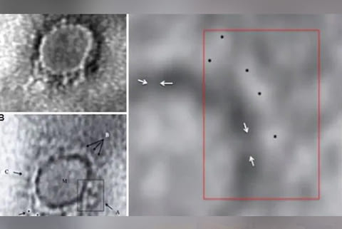 First electron microscope images of Covid-19 virus in India released