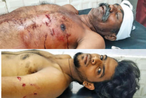 U Duraisamy and M Haribaskar undergoing treatment on Saturday