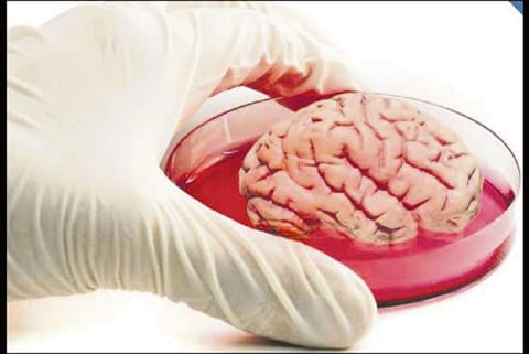Tiny robotic thread can slip through brain's blood vessels