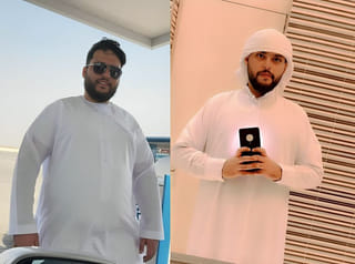 UAE: Robotic surgery helps 120kg Emirati man lose 35kg, reduce obesity