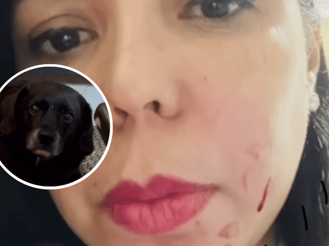 The incident has led Filipina actress Alma Concepcion and her family to make significant changes in how they interact with their beloved pet.

