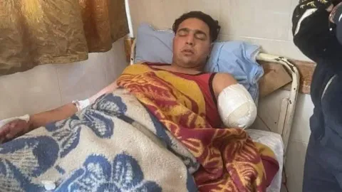 Due to the severity of his injuries, doctors were forced to amputate his left arm.
