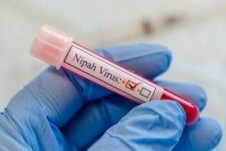 Nipah vaccine trials begin as India battles virus outbreak in Kerala