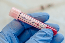 First identified in Malaysia in 1999, the Nipah virus has triggered several deadly outbreaks across South and Southeast Asia.