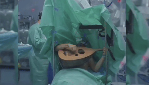 The procedure, which was conducted under local anesthesia, captivated social media after a video of the scene went viral.