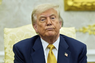 Trump diagnosed with vein issue after reporting swollen legs: What we know
