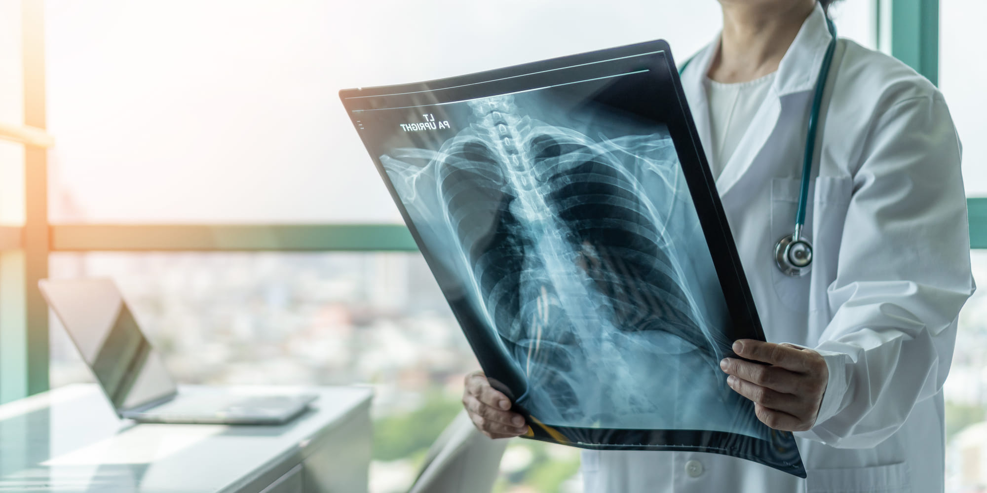 Lung Cancer