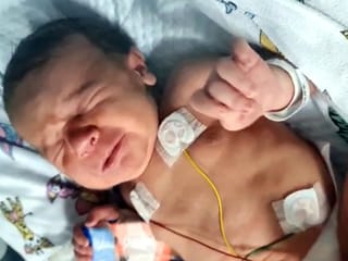 Hero aunt saves five-month-old baby in UAE’s youngest liver transplant