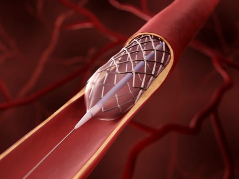 Next-generation cardiac treatments: From nanotech to interventional excellence