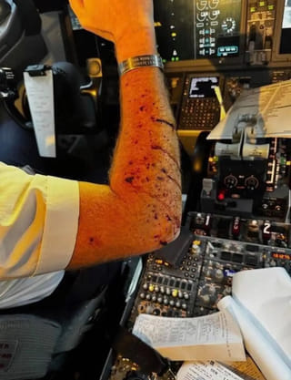 Midair horror: Boeing 737 windshield cracks at 36,000 Feet, pilot injured in emergency landing drama