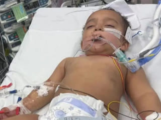 Baby drinks drain cleaner thinking it’s milk, suffers heart attack and severe tongue loss
