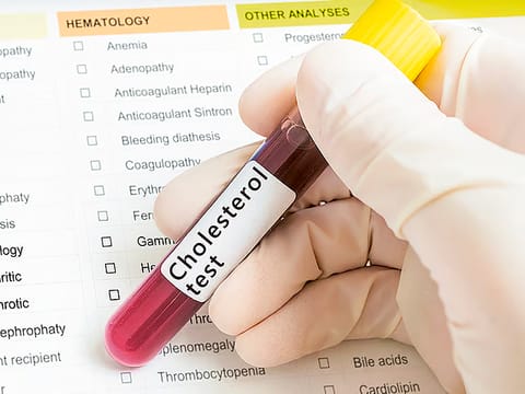 Over half of UAE adults have high cholesterol, 96% exceed sodium intake, national survey reveals