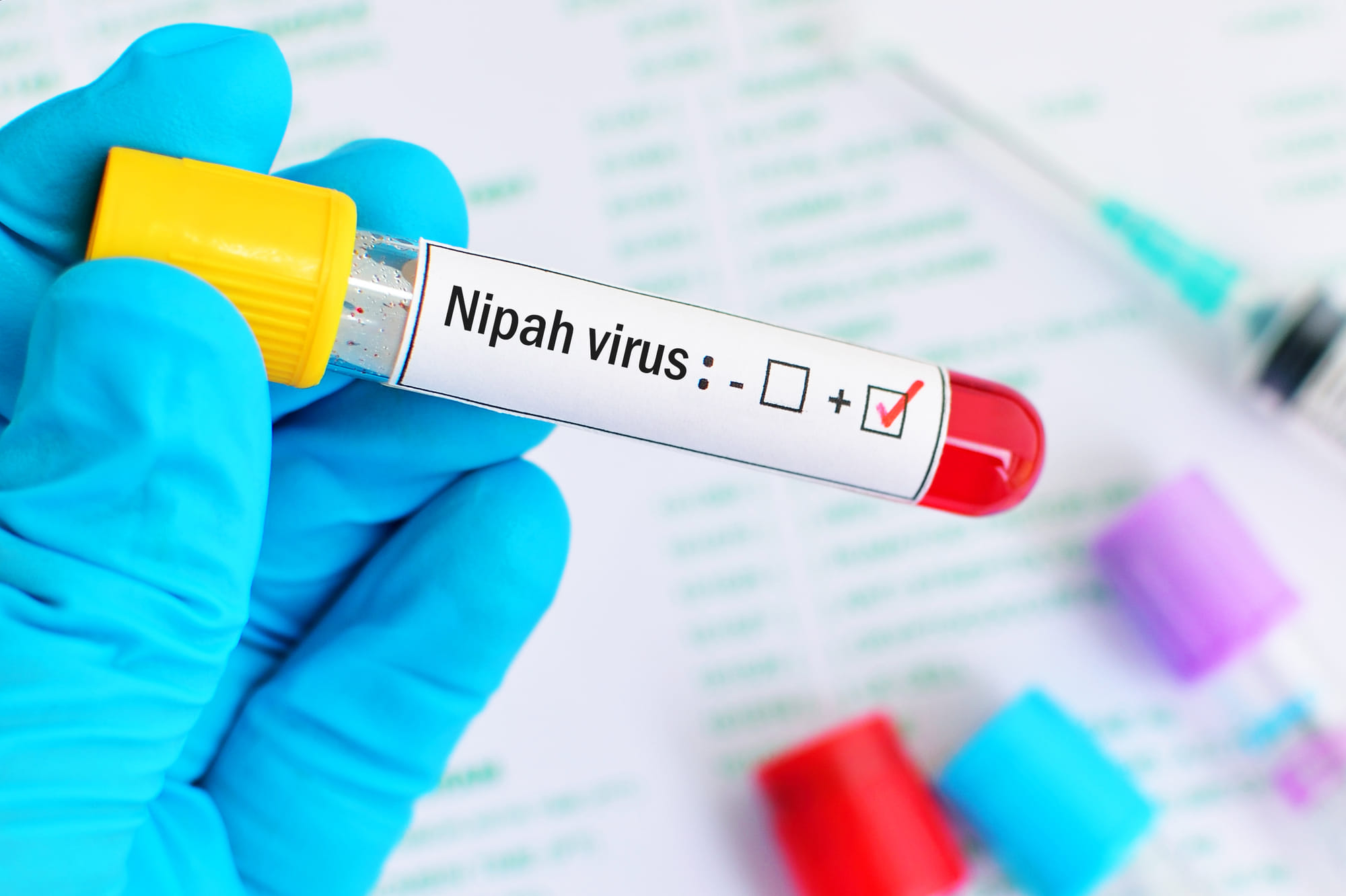 Nipah virus