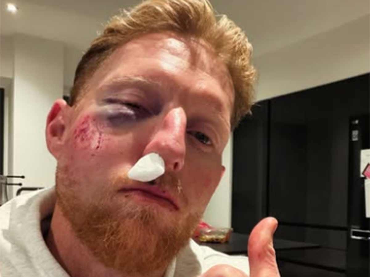Injured Ben Stokes