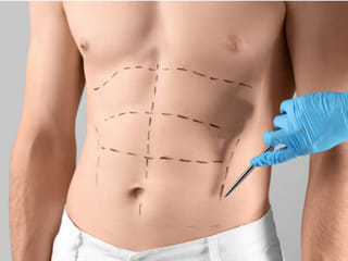 How modern abdominoplasty is solving chronic back pain