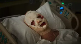This version of Hagen is portrayed as a tragic, revenge-driven figure, transformed by a scientific experiment gone catastrophically wrong.