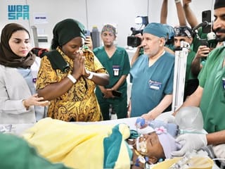 The operation is the third successful separation of conjoined twins from Tanzania and the 71st procedure carried out under the Saudi Conjoined Twins Programme.